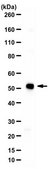 Anti-Alpha 2b Adrenergic Receptor from rabbit, purified by affinity chromatography