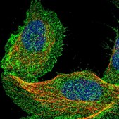 Anti-DCBLD2 antibody produced in rabbit Prestige Antibodies&#174; Powered by Atlas Antibodies, affinity isolated antibody, buffered aqueous glycerol solution