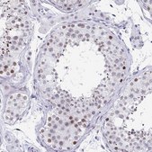 Anti-WDR72 antibody produced in rabbit Prestige Antibodies&#174; Powered by Atlas Antibodies, affinity isolated antibody, buffered aqueous glycerol solution