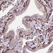 Monoclonal Anti-FBN1 antibody produced in mouse Prestige Antibodies&#174; Powered by Atlas Antibodies, clone CL0225, purified immunoglobulin, buffered aqueous glycerol solution