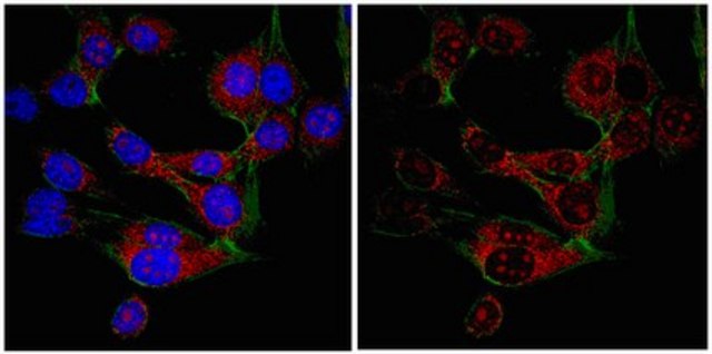 Anti-SRp30a (SF2) Antibody from rabbit