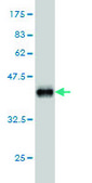 Monoclonal Anti-FLVCR antibody produced in mouse clone 4B2, purified immunoglobulin, buffered aqueous solution