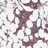 Anti-DOCK2 antibody produced in rabbit Prestige Antibodies&#174; Powered by Atlas Antibodies, affinity isolated antibody, buffered aqueous glycerol solution