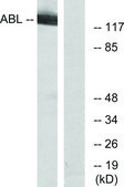 Anti-C-ABL antibody produced in rabbit affinity isolated antibody