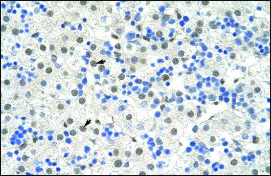 Anti-NOBOX (AB1) antibody produced in rabbit affinity isolated antibody
