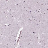 Anti-MKI67 antibody produced in rabbit Ab2, Prestige Antibodies&#174; Powered by Atlas Antibodies, affinity isolated antibody, buffered aqueous glycerol solution