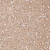 Anti-L1CAM antibody produced in rabbit Prestige Antibodies&#174; Powered by Atlas Antibodies, affinity isolated antibody, buffered aqueous glycerol solution
