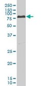 ANTI-PRKCI antibody produced in mouse clone 1C10, purified immunoglobulin, buffered aqueous solution