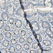 Anti-TPX2 antibody produced in rabbit Prestige Antibodies&#174; Powered by Atlas Antibodies, affinity isolated antibody, buffered aqueous glycerol solution
