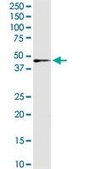Anti-IDH3G antibody produced in rabbit purified immunoglobulin, buffered aqueous solution