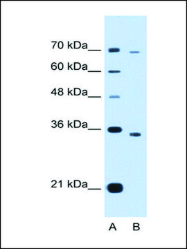 Anti-PHF6 (AB1) antibody produced in rabbit IgG fraction of antiserum