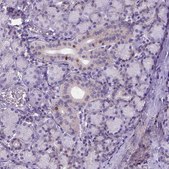 Anti-FOXI1 antibody produced in rabbit Prestige Antibodies&#174; Powered by Atlas Antibodies, affinity isolated antibody, buffered aqueous glycerol solution