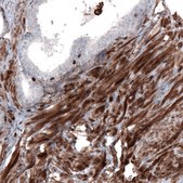 Monoclonal Anti-ZYX antibody produced in mouse Prestige Antibodies&#174; Powered by Atlas Antibodies, clone CL2502, purified immunoglobulin, buffered aqueous glycerol solution