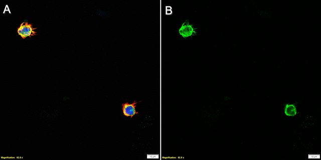 Anti-CD64 Antibody, clone 1B5 ZooMAb&#174; Rabbit Monoclonal recombinant, expressed in HEK 293 cells