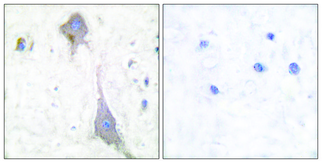 Anti-MGLUR7 antibody produced in rabbit affinity isolated antibody