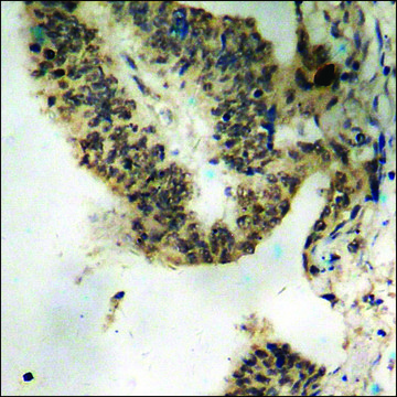 Anti-phospho-ATRIP (pSer68) antibody produced in rabbit affinity isolated antibody