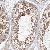 Anti-WDR77 antibody produced in rabbit Prestige Antibodies&#174; Powered by Atlas Antibodies, affinity isolated antibody, buffered aqueous glycerol solution, ab2