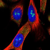 Anti-METTL5 antibody produced in rabbit Prestige Antibodies&#174; Powered by Atlas Antibodies, affinity isolated antibody, buffered aqueous glycerol solution