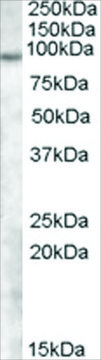Anti-TCHHL1 antibody produced in goat affinity isolated antibody, buffered aqueous solution