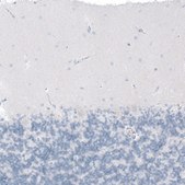 Anti-CFTR antibody produced in rabbit Prestige Antibodies&#174; Powered by Atlas Antibodies, affinity isolated antibody, buffered aqueous glycerol solution