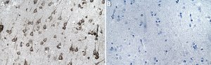 Anti-MAP3K8 Antibody, clone 1D11 ZooMAb&#174; Rabbit Monoclonal recombinant, expressed in HEK 293 cells