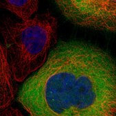 Anti-LDHB antibody produced in rabbit Prestige Antibodies&#174; Powered by Atlas Antibodies, affinity isolated antibody, buffered aqueous glycerol solution