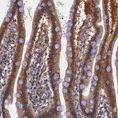 Anti-IGBP1 antibody produced in rabbit Ab1, Prestige Antibodies&#174; Powered by Atlas Antibodies, affinity isolated antibody, buffered aqueous glycerol solution