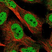 Anti-KLHDC3 antibody produced in rabbit Prestige Antibodies&#174; Powered by Atlas Antibodies, affinity isolated antibody, buffered aqueous glycerol solution, ab1