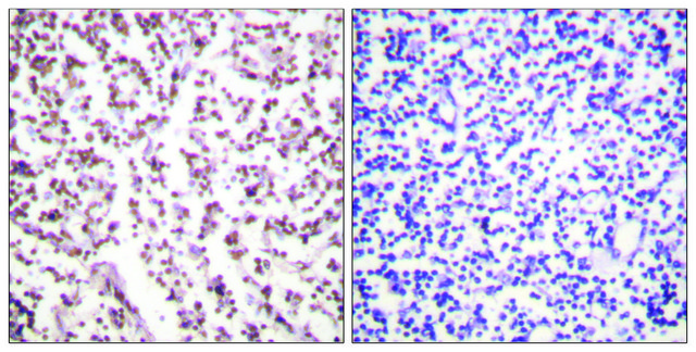 Anti-Bloom Syndrome antibody produced in rabbit affinity isolated antibody