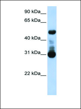 Anti-ACVRL1 antibody produced in rabbit affinity isolated antibody