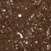 Anti-ICAM5 antibody produced in rabbit Ab1, Prestige Antibodies&#174; Powered by Atlas Antibodies, affinity isolated antibody, buffered aqueous glycerol solution