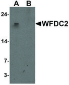 Anti-WFDC2 antibody produced in rabbit affinity isolated antibody