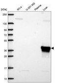 Anti-Aldob Antibody Produced In Rabbit Prestige Antibodies&#174; Powered by Atlas Antibodies, affinity isolated antibody, buffered aqueous glycerol solution