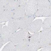 Anti-PSMB10 antibody produced in rabbit Prestige Antibodies&#174; Powered by Atlas Antibodies, affinity isolated antibody, buffered aqueous glycerol solution