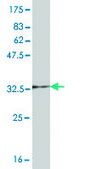 Monoclonal Anti-UBE2D1 antibody produced in mouse clone 2C6, purified immunoglobulin, buffered aqueous solution