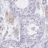 Anti-THSD7A antibody produced in rabbit Prestige Antibodies&#174; Powered by Atlas Antibodies, affinity isolated antibody, buffered aqueous glycerol solution