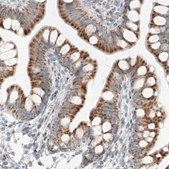 Monoclonal Anti-SDHB antibody produced in mouse Prestige Antibodies&#174; Powered by Atlas Antibodies, clone CL0346, purified immunoglobulin, buffered aqueous glycerol solution