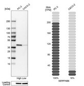 Anti-SERPINB6 antibody produced in rabbit Ab1, Prestige Antibodies&#174; Powered by Atlas Antibodies, affinity isolated antibody, buffered aqueous glycerol solution