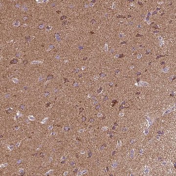 Anti-MAPK11 antibody produced in rabbit Prestige Antibodies&#174; Powered by Atlas Antibodies, affinity isolated antibody, buffered aqueous glycerol solution