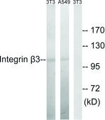 Anti-Integrin &#946;3 antibody produced in rabbit affinity isolated antibody