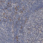Anti-MOGS antibody produced in rabbit Prestige Antibodies&#174; Powered by Atlas Antibodies, affinity isolated antibody, buffered aqueous glycerol solution