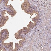 Anti-ATAT1 antibody produced in rabbit Prestige Antibodies&#174; Powered by Atlas Antibodies, affinity isolated antibody, buffered aqueous glycerol solution
