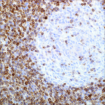 BCL2 (SP66) Rabbit Monoclonal Antibody