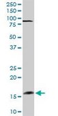 Anti-FGF1 antibody produced in rabbit purified immunoglobulin, buffered aqueous solution