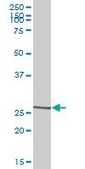 Anti-CLEC5A antibody produced in mouse IgG fraction of antiserum, buffered aqueous solution