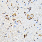 Anti-HSPA4 antibody produced in rabbit