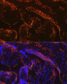 Anti-Aromatase (CYP19A1) Antibody, clone 5C5N7, Rabbit Monoclonal