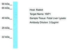 Anti-YAP1 antibody produced in rabbit affinity isolated antibody