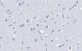 Anti-LC3A Antibody, clone 3J12 ZooMAb&#174; Rabbit Monoclonal recombinant, expressed in HEK 293 cells