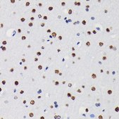 Anti- HDAC1 antibody produced in rabbit